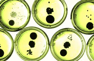 Analyses microbiologiques